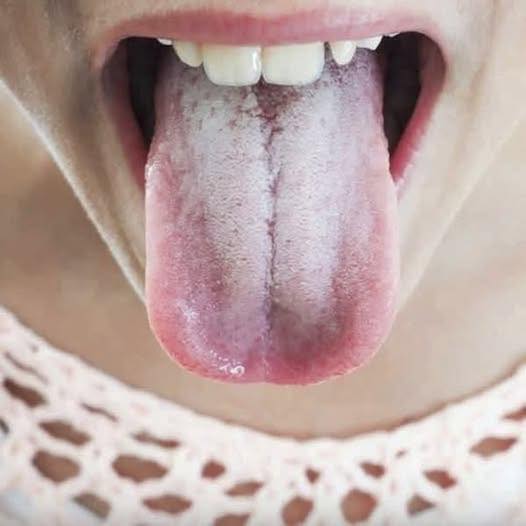 When White Bumps Appear Under Your Eyes, Your Body Might Be Telling You Something 