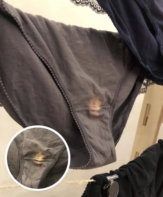 What a Bleach-Like Spot Could Mean